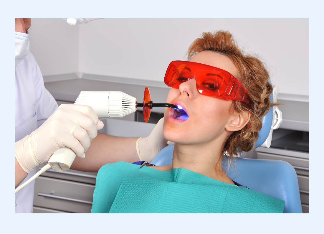 Tooth-Coloured Fillings