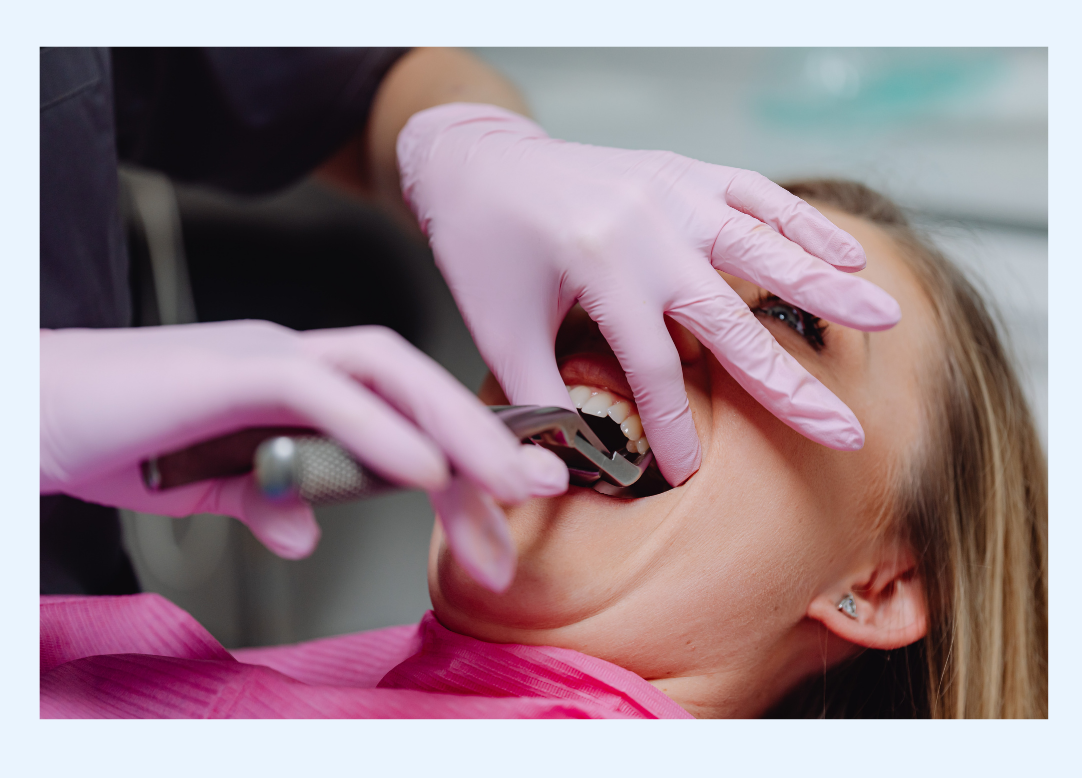 Wisdom Tooth Removal